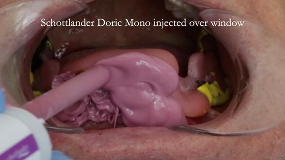 Ken – going downhill, first class