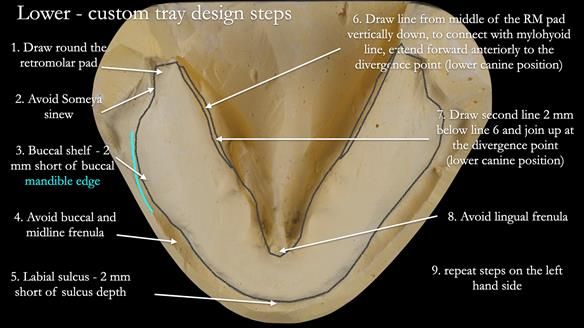 Newsletter 53 showing the making and fitting of ultra life-like dentures for Valena