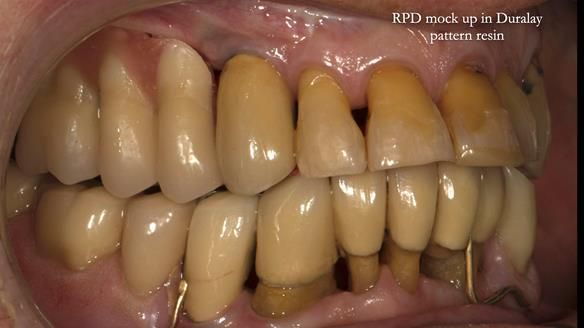 Ken – going downhill, first class