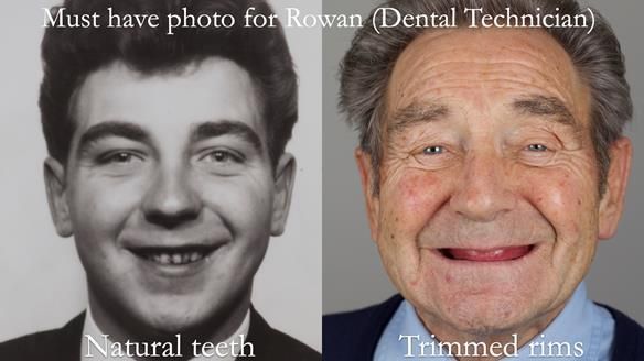 Newsletter 50 Special edition Complete Dentures FULL PROTOCOL