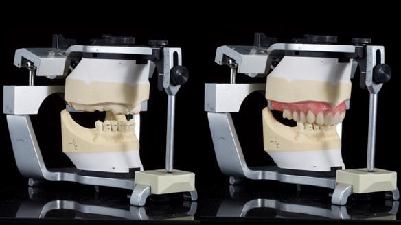 Newsletter 79 – Creating a wonderful smile and changing a life.