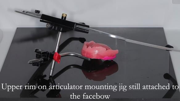 Newsletter 50 Special edition Complete Dentures FULL PROTOCOL