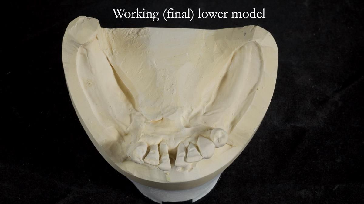 Newsletter 87 – Father Peter: A Partial Denture that needed Minor Miracle