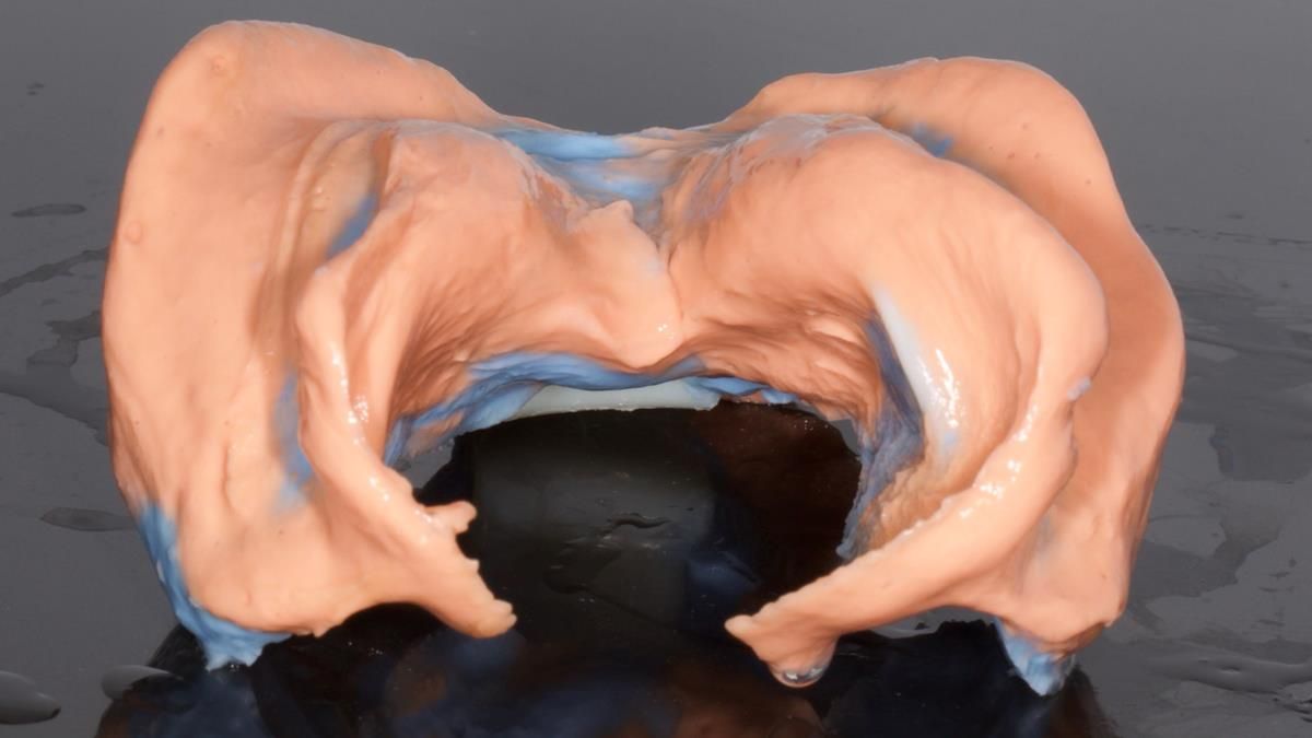 Fin’s Newsletter 88 — Complete dentures - full protocol… he rearranged his own teeth!