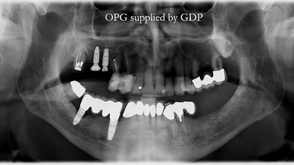 Ken – going downhill, first class