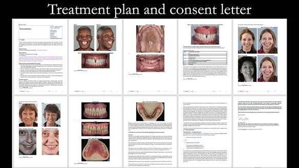 Newsletter 53 showing the making and fitting of ultra life-like dentures for Valena