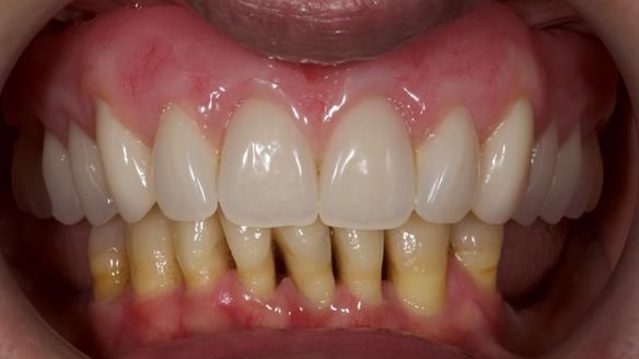 Newsletter 79 – Creating a wonderful smile and changing a life.