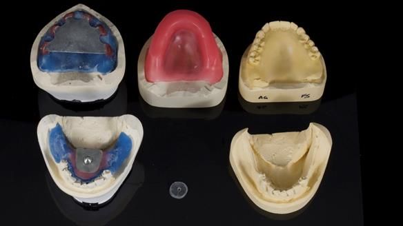 Newsletter 79 – Creating a wonderful smile and changing a life.