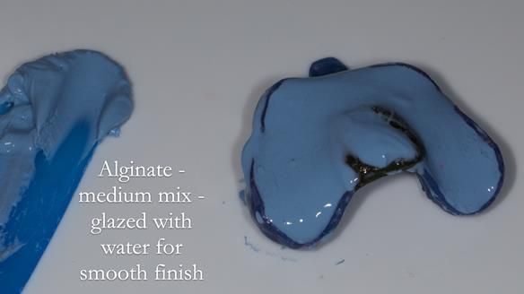 Newsletter 81 - Pam’s Story — how a partial denture changed her life (+ live walkthrough this Thursday)