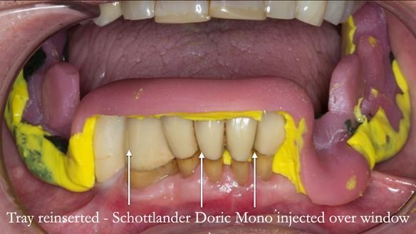 Ken – going downhill, first class