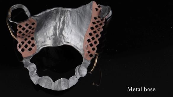 Finlay's Newsletter 60 Sylvia's upper Kennedy Class 2 Mod 1 metal based upper RPD