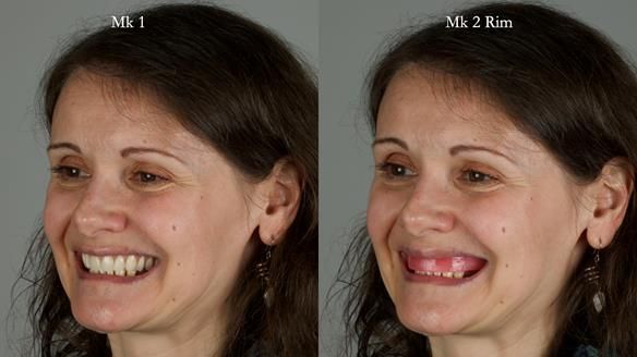 Newsletter 79 – Creating a wonderful smile and changing a life.