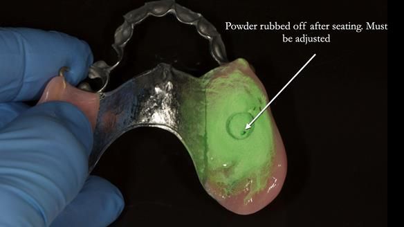 Ken – going downhill, first class