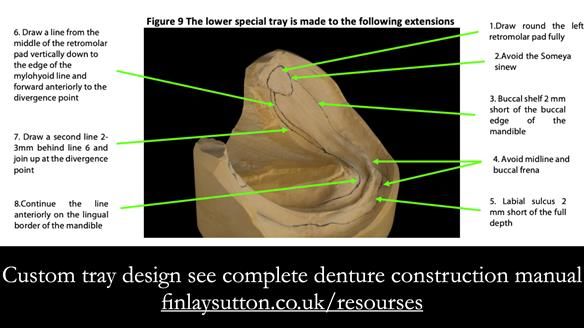 Newsletter 53 showing the making and fitting of ultra life-like dentures for Valena
