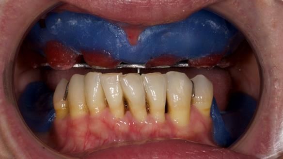 Newsletter 79 – Creating a wonderful smile and changing a life.
