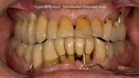 Ken – going downhill, first class