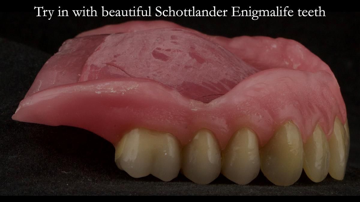 Newsletter 87 – Father Peter: A Partial Denture that needed Minor Miracle