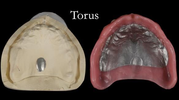 Newsletter 79 – Creating a wonderful smile and changing a life.