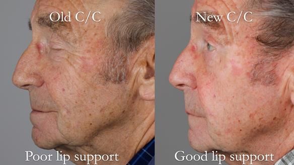 Newsletter 50 Special edition Complete Dentures FULL PROTOCOL