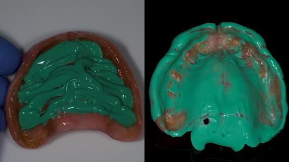 Newsletter 79 – Creating a wonderful smile and changing a life.