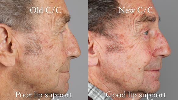 Newsletter 50 Special edition Complete Dentures FULL PROTOCOL