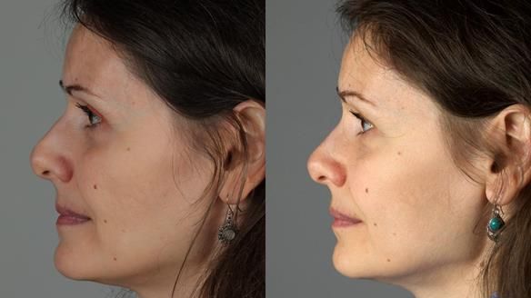 Newsletter 79 – Creating a wonderful smile and changing a life.