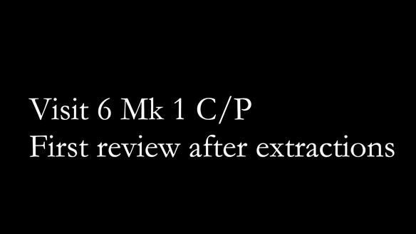 Newsletter 52 Managing Jo’s failing dentition with extractions and Mk 1/Mk 2 complete upper dentures and lower partial dentures FULL PROTOCOL
