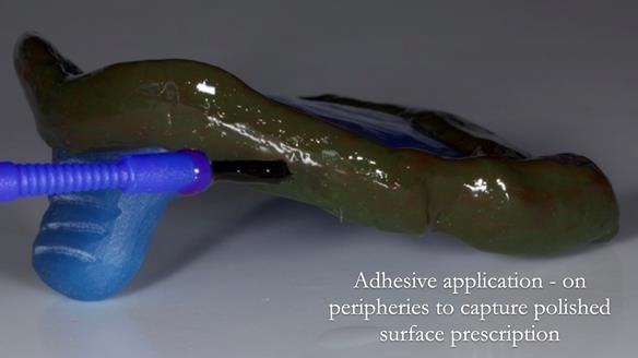 Newsletter 83: Sheila’s Complete Denture Success