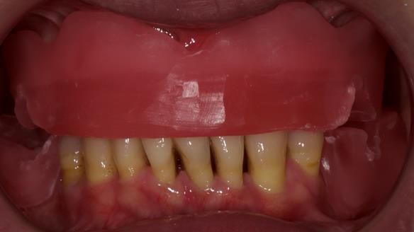 Newsletter 79 – Creating a wonderful smile and changing a life.