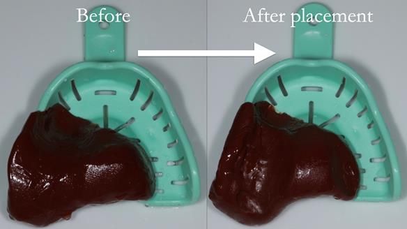 Finlay's Newsletter 60 Sylvia's upper Kennedy Class 2 Mod 1 metal based upper RPD