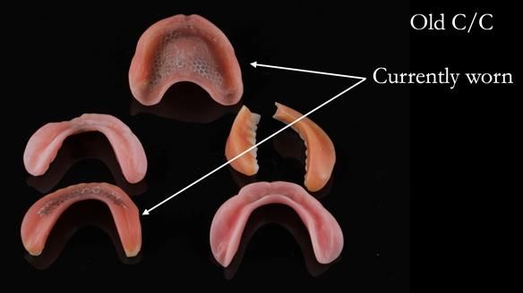 Newsletter 50 Special edition Complete Dentures FULL PROTOCOL