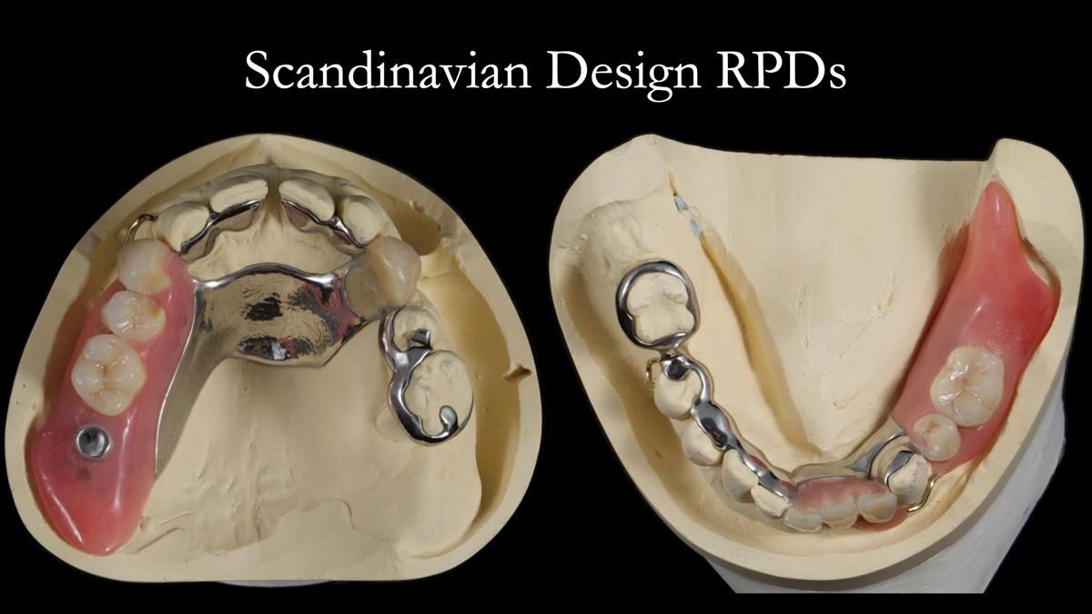 Newsletter 86 Peter the Architect — precision removable partial dentures case study