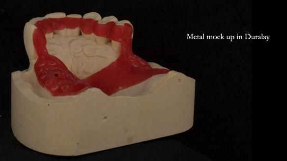 Ken – going downhill, first class