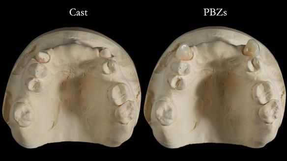 Newsletter 81 - Pam’s Story — how a partial denture changed her life (+ live walkthrough this Thursday)