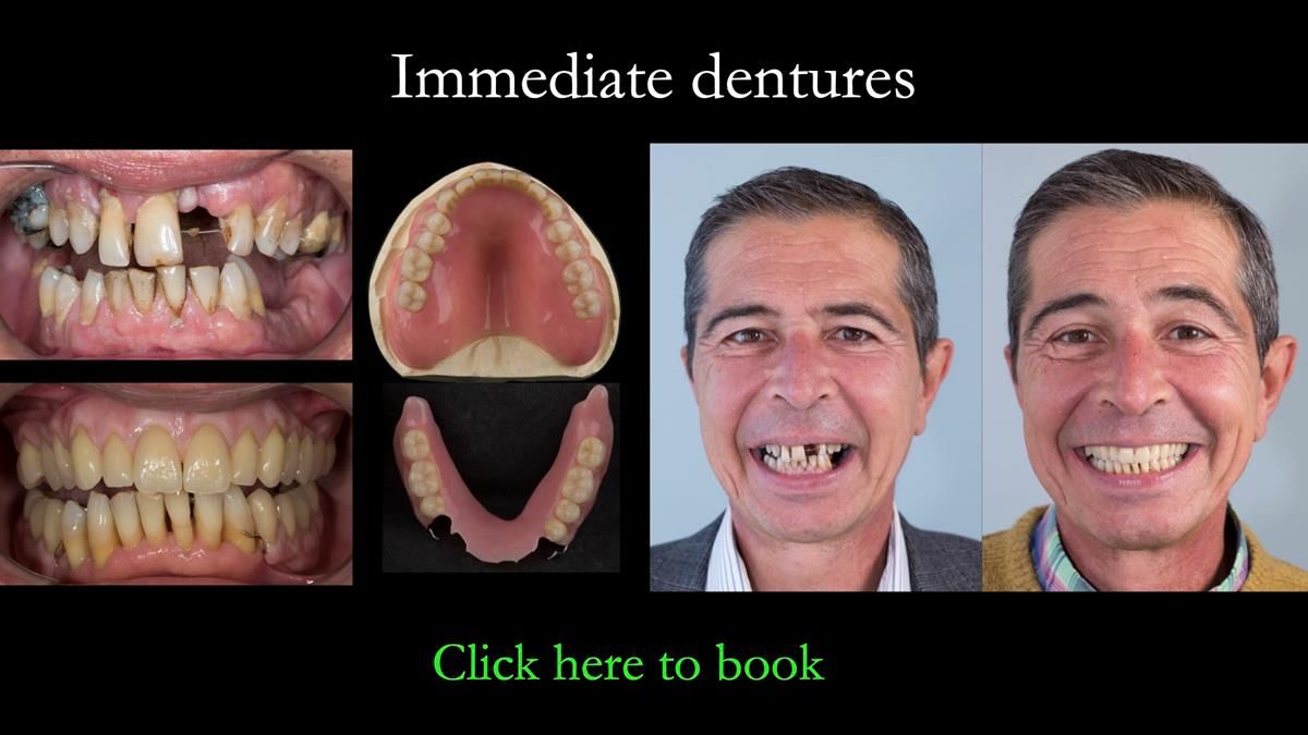 Newsletter 87 – Father Peter: A Partial Denture that needed Minor Miracle