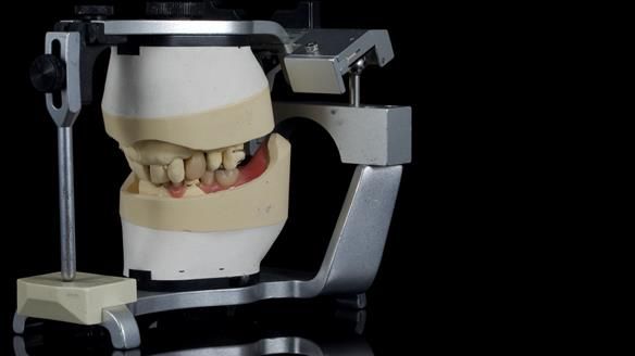 Newsletter 86 Peter the Architect — precision removable partial dentures case study