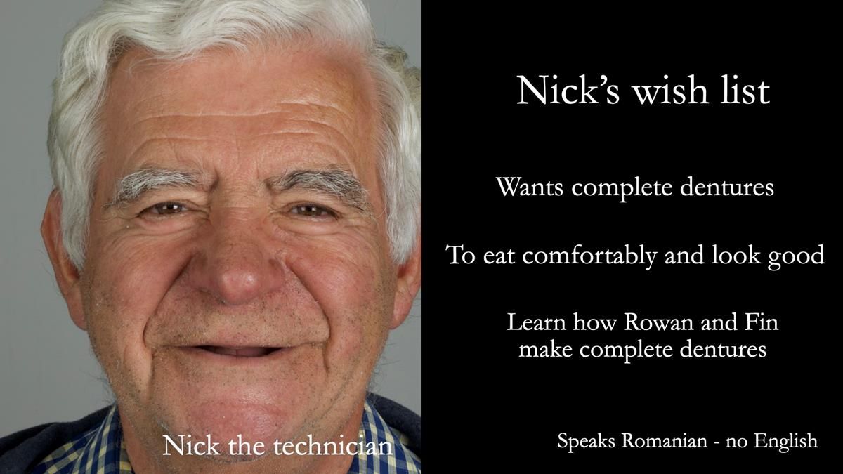 Fin’s Newsletter 88 — Complete dentures - full protocol… he rearranged his own teeth!