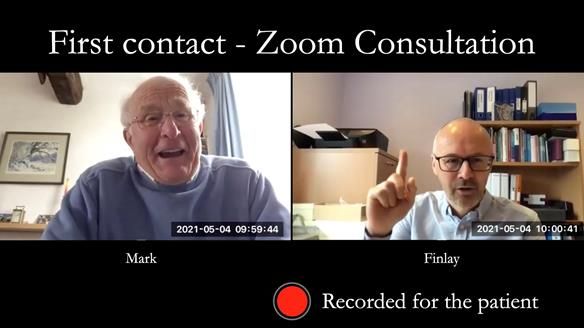 Complete denture Class II div 2 deep overbite Newsletter 39