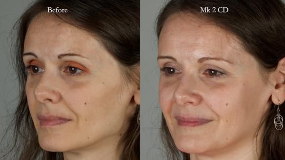 Newsletter 79 – Creating a wonderful smile and changing a life.