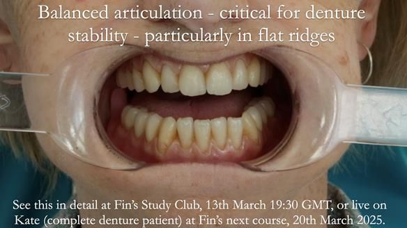 Newsletter 75: Marion’s case - Step-by-step complete denture workflow