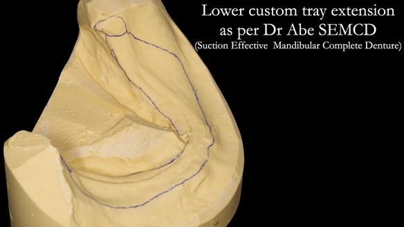 Newsletter 50 Special edition Complete Dentures FULL PROTOCOL