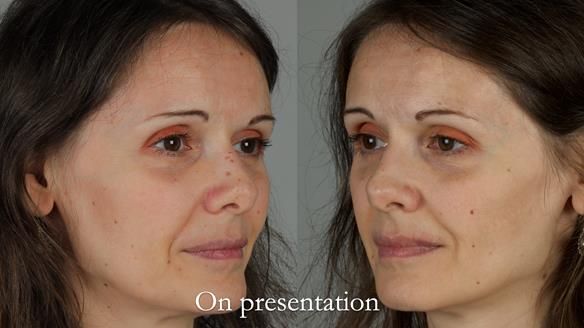 Newsletter 79 – Creating a wonderful smile and changing a life.