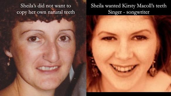 Newsletter 83: Sheila’s Complete Denture Success