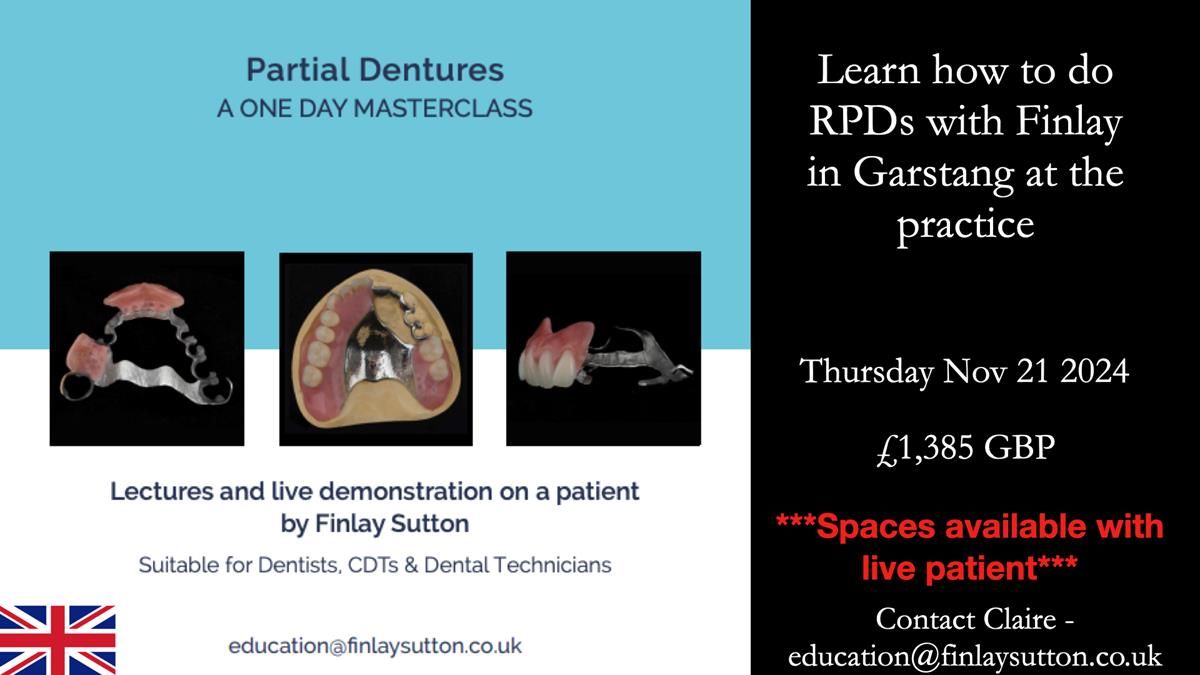 Finlay's Newsletter 61 provision of a lower unilateral free end saddle metal based partial denture for Joyce