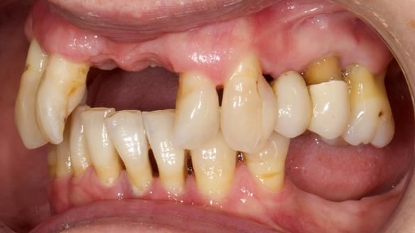 Newsletter 79 – Creating a wonderful smile and changing a life.