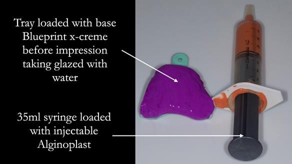 Replacing Madeline’s Complete denture FULL PROTOCOL
