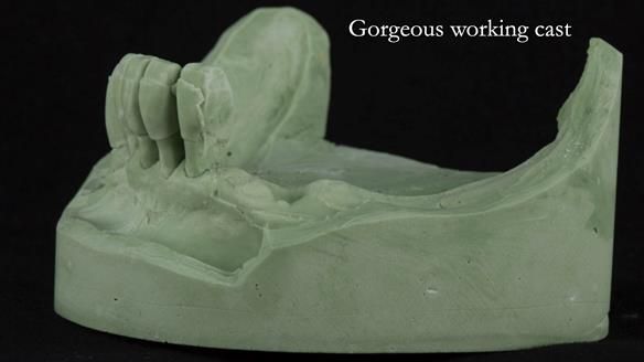 Ken – going downhill, first class