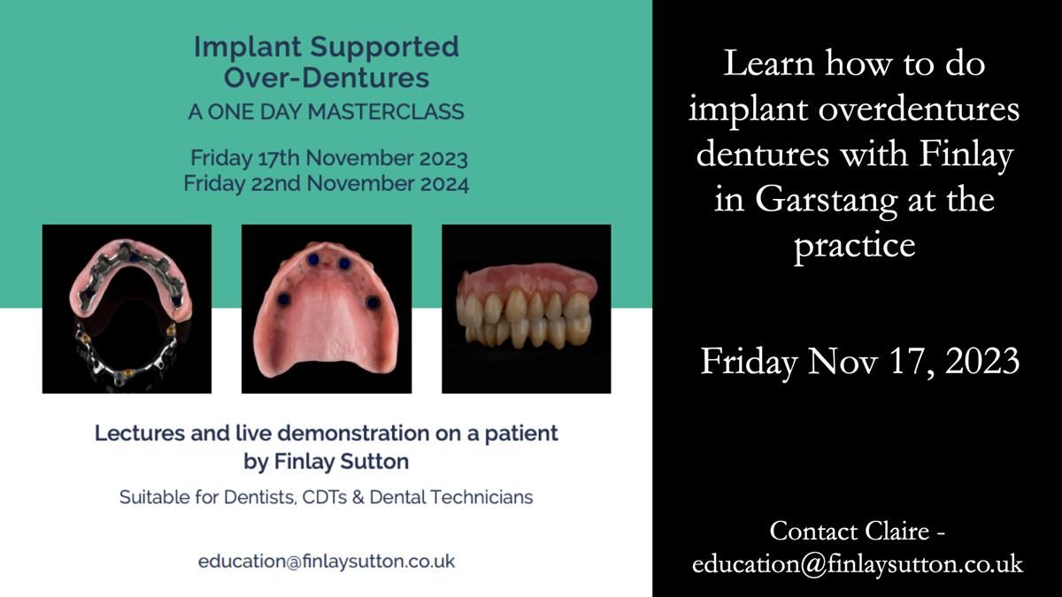 Newsletter 51 Managing Anne’s failing dentition with distal extension base RPD/Splint FULL PROTOCOL