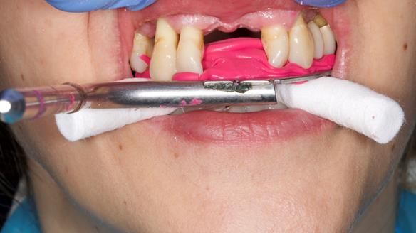 Newsletter 79 – Creating a wonderful smile and changing a life.