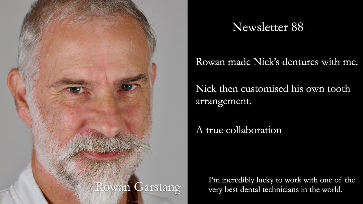 Fin’s Newsletter 88 — Complete dentures - full protocol… he rearranged his own teeth!